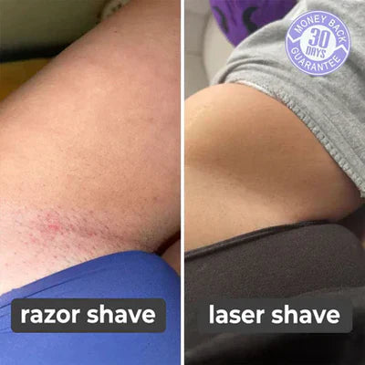 SILK SMOOTH™ - Laser Hair Remover (75% OFF TODAY ONLY!)